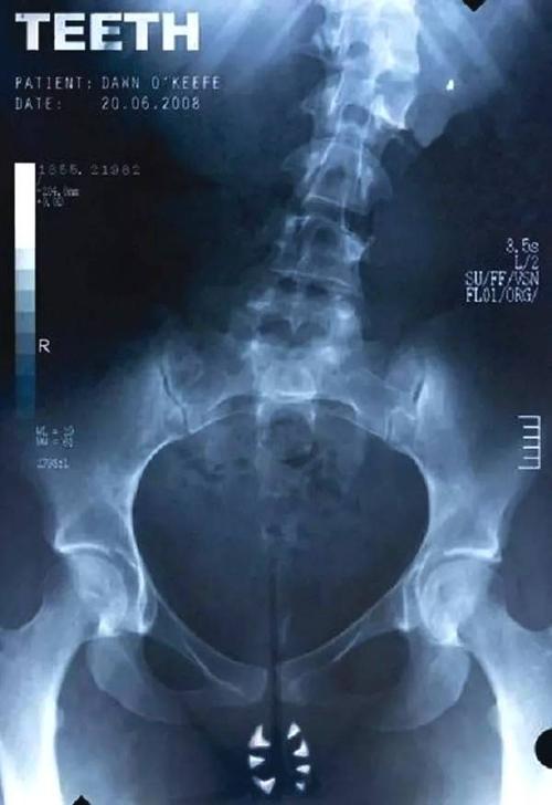 格罗宁根汉泽大学 Physics degree